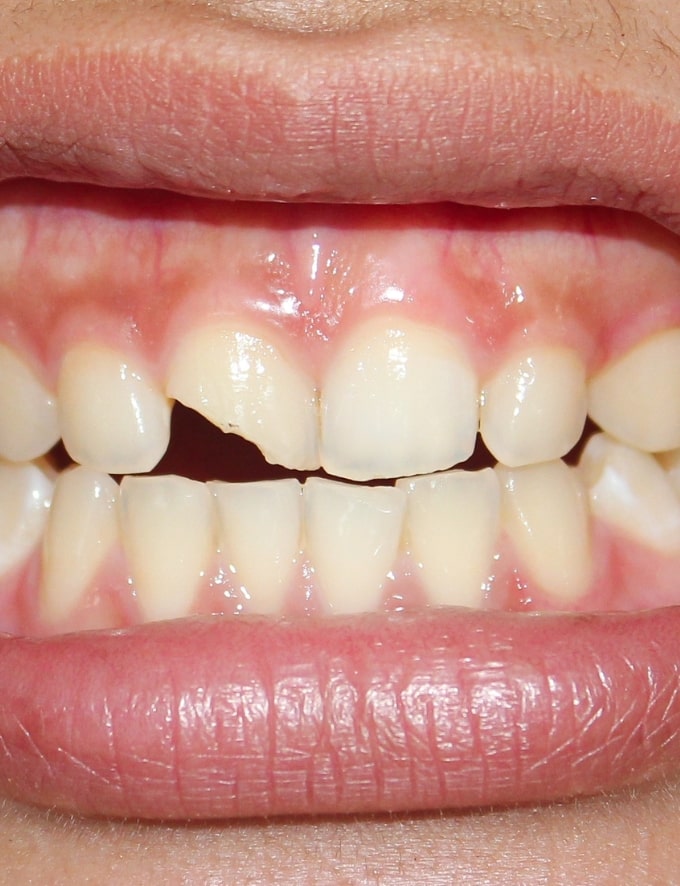 Treatment - Conway House Dental