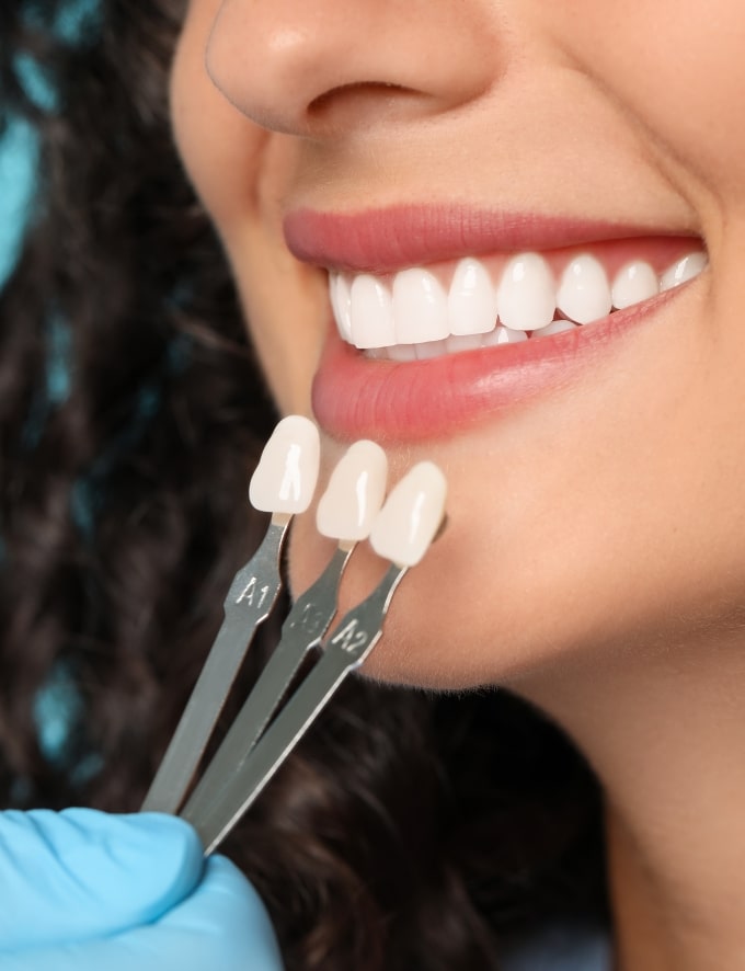 Treatment - Conway House Dental