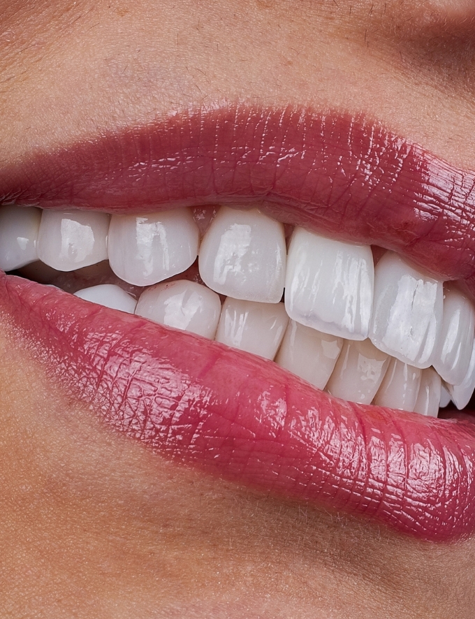 Treatment - Conway House Dental