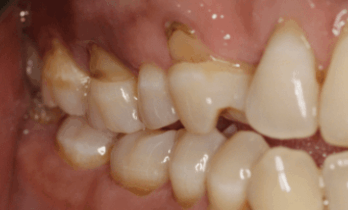 Before - Conway House Dental