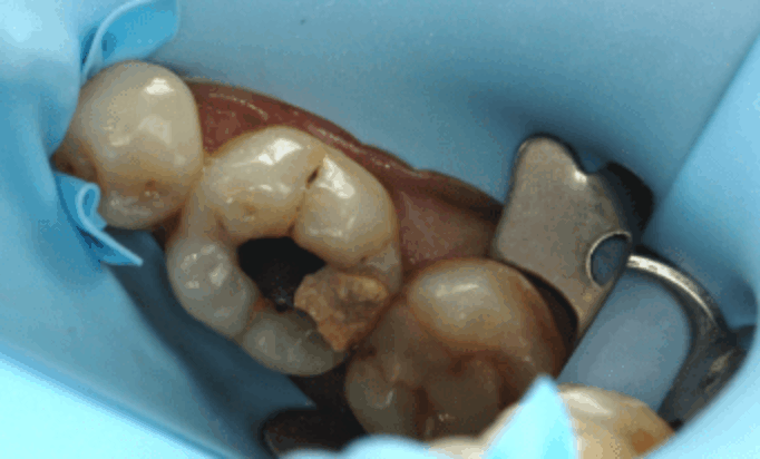 Before - Conway House Dental