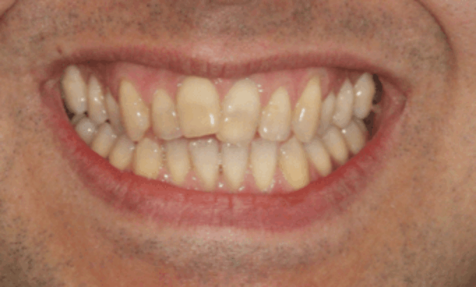 Before - Conway House Dental