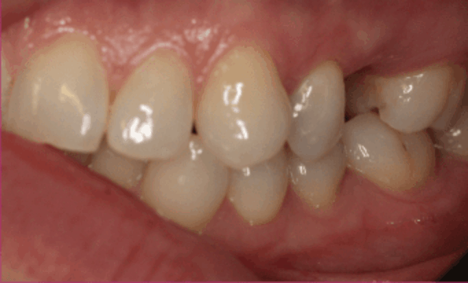 Before - Conway House Dental