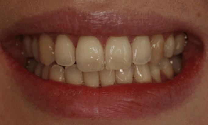 Before - Conway House Dental