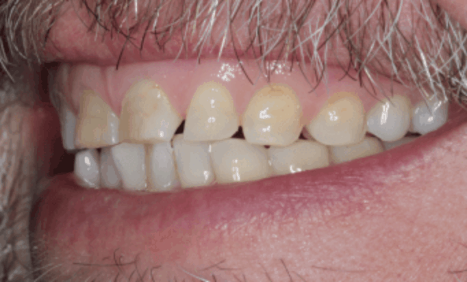 Before - Conway House Dental