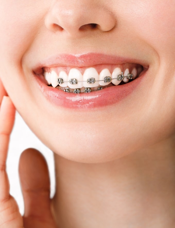 Treatment - Conway House Dental