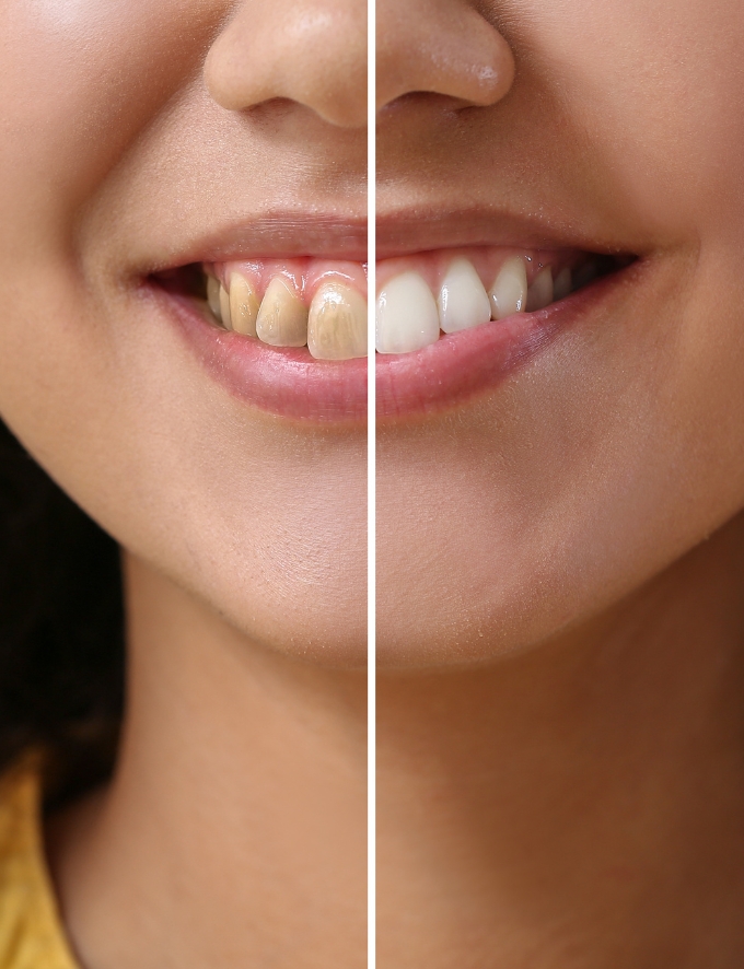 Treatment - Conway House Dental