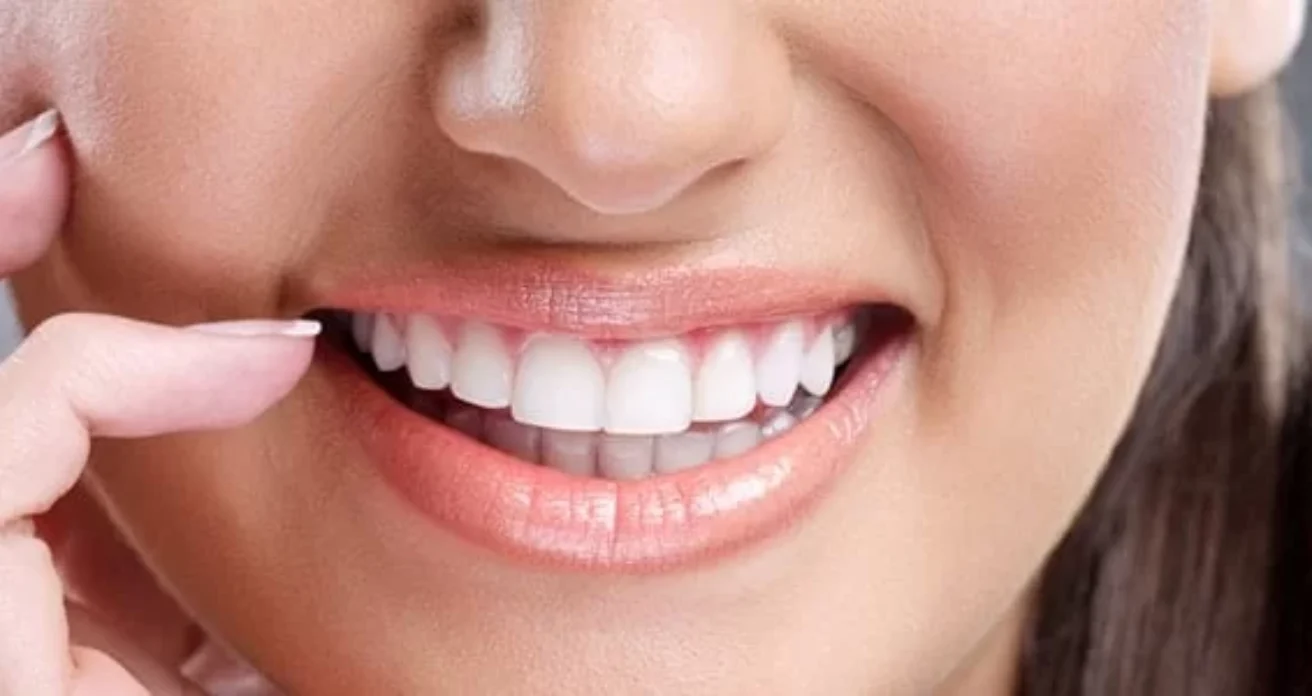 Blog -Conway House Dental