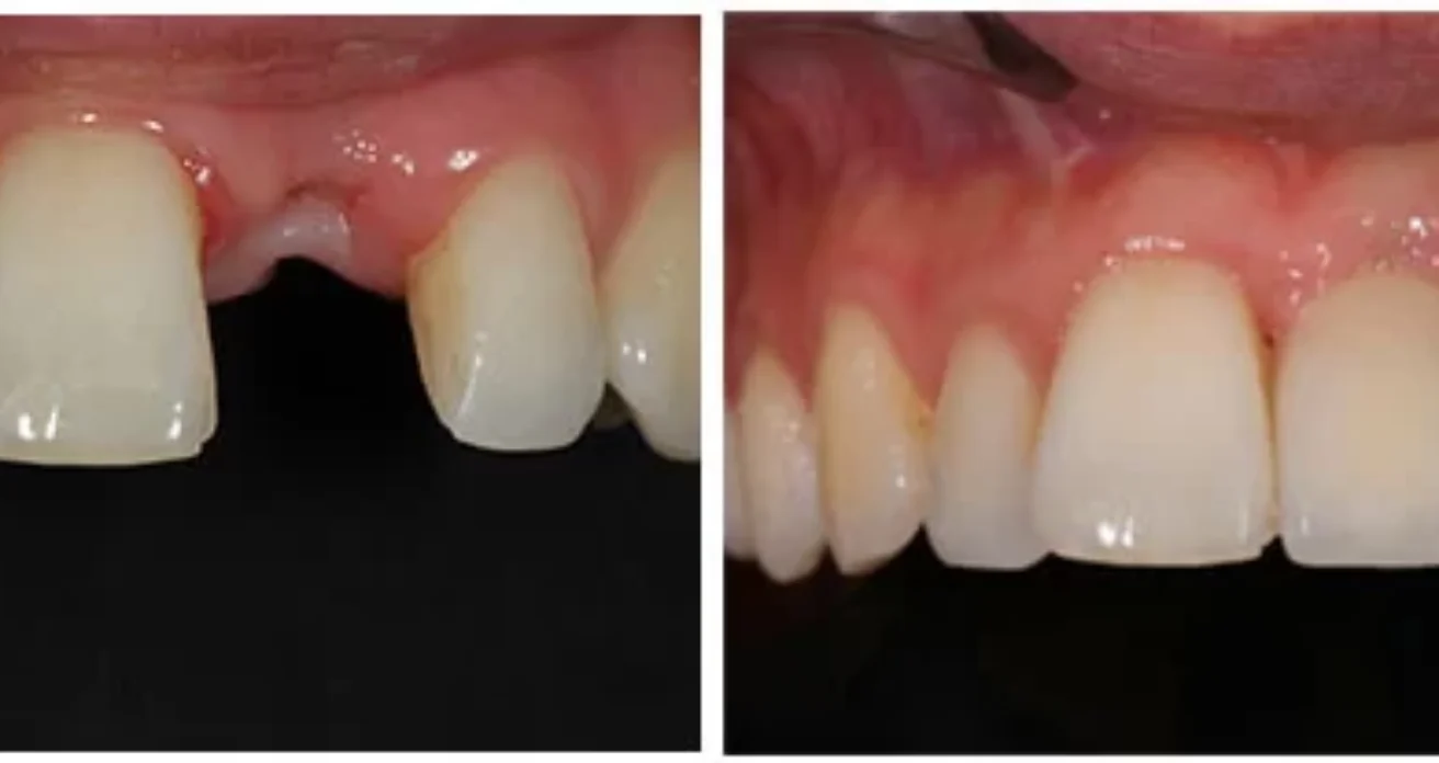 Blog -Conway House Dental