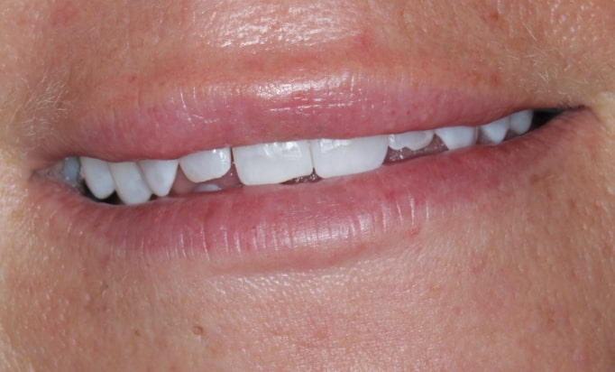 Before - Conway House Dental