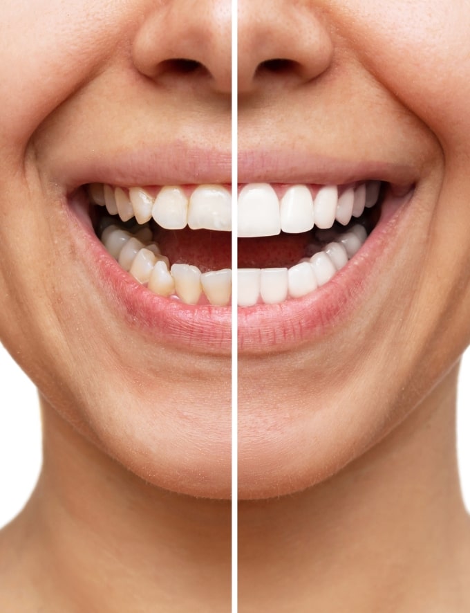 Treatment -  Conway House Dental