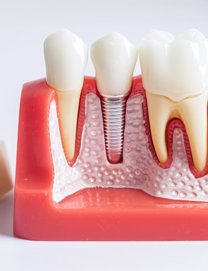 Treatment -  Conway House Dental