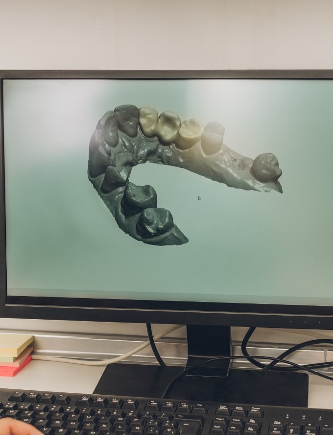 Treatment -  Conway House Dental